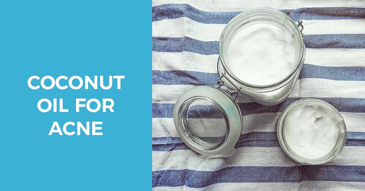 Benefits of coconut oil for acne prone skin